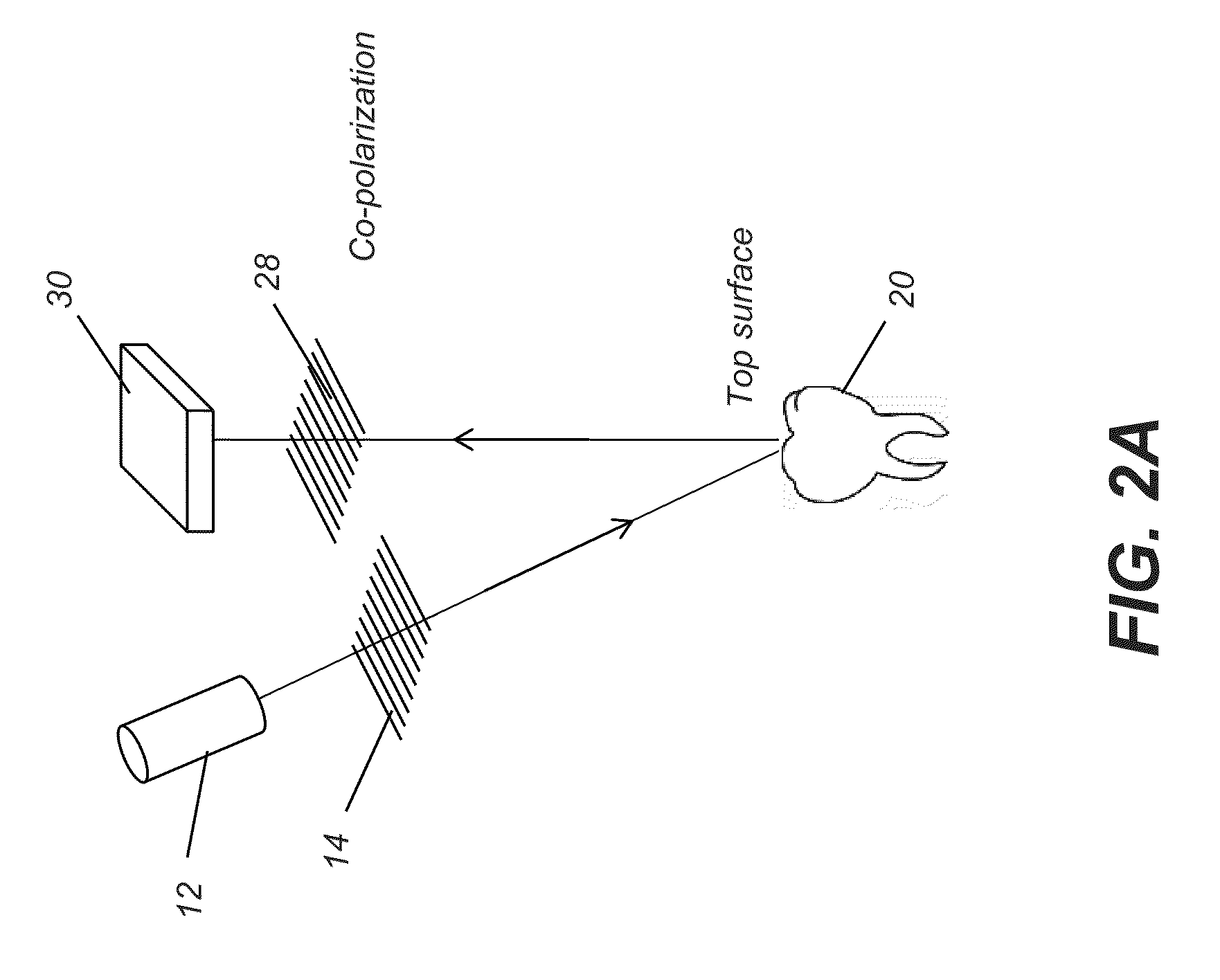System and method for detecting tooth cracks