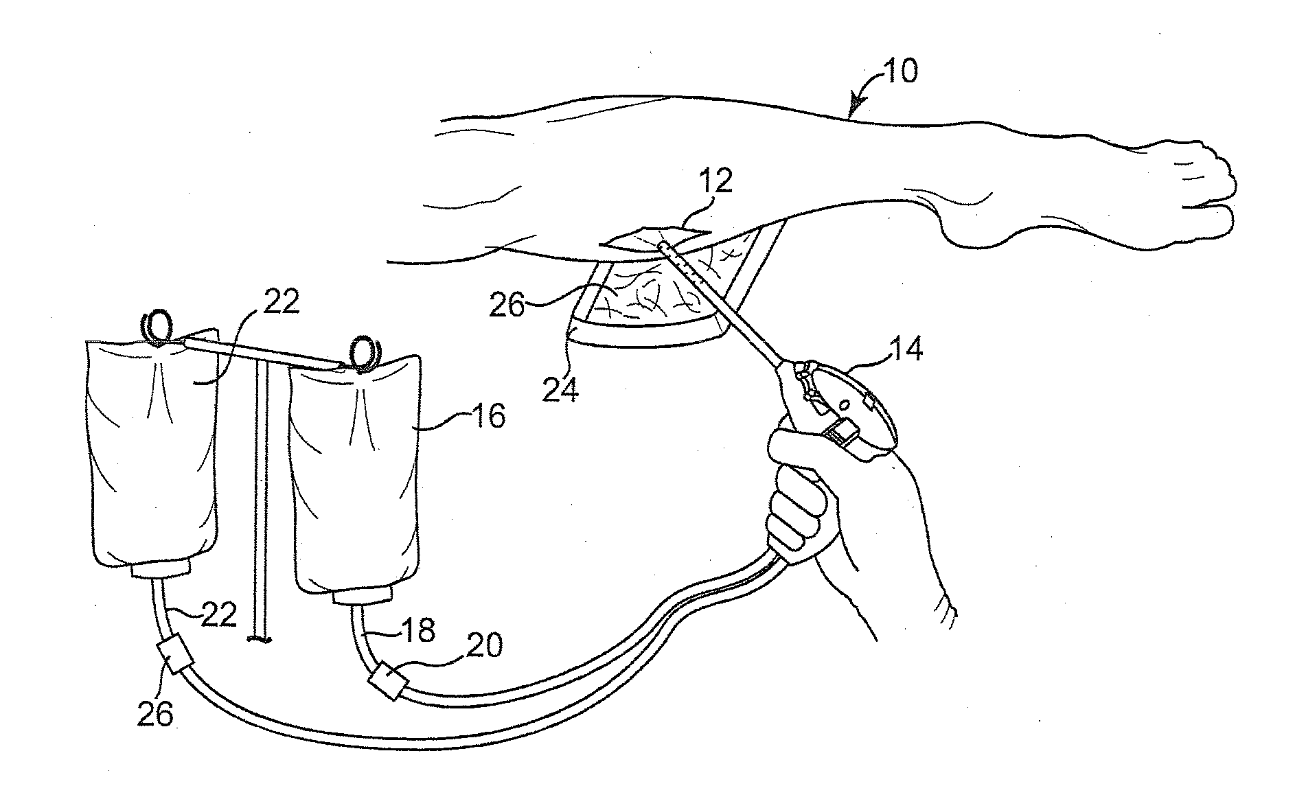 Method for treating chronic wounds with an extracellular polymeric substance solvating system