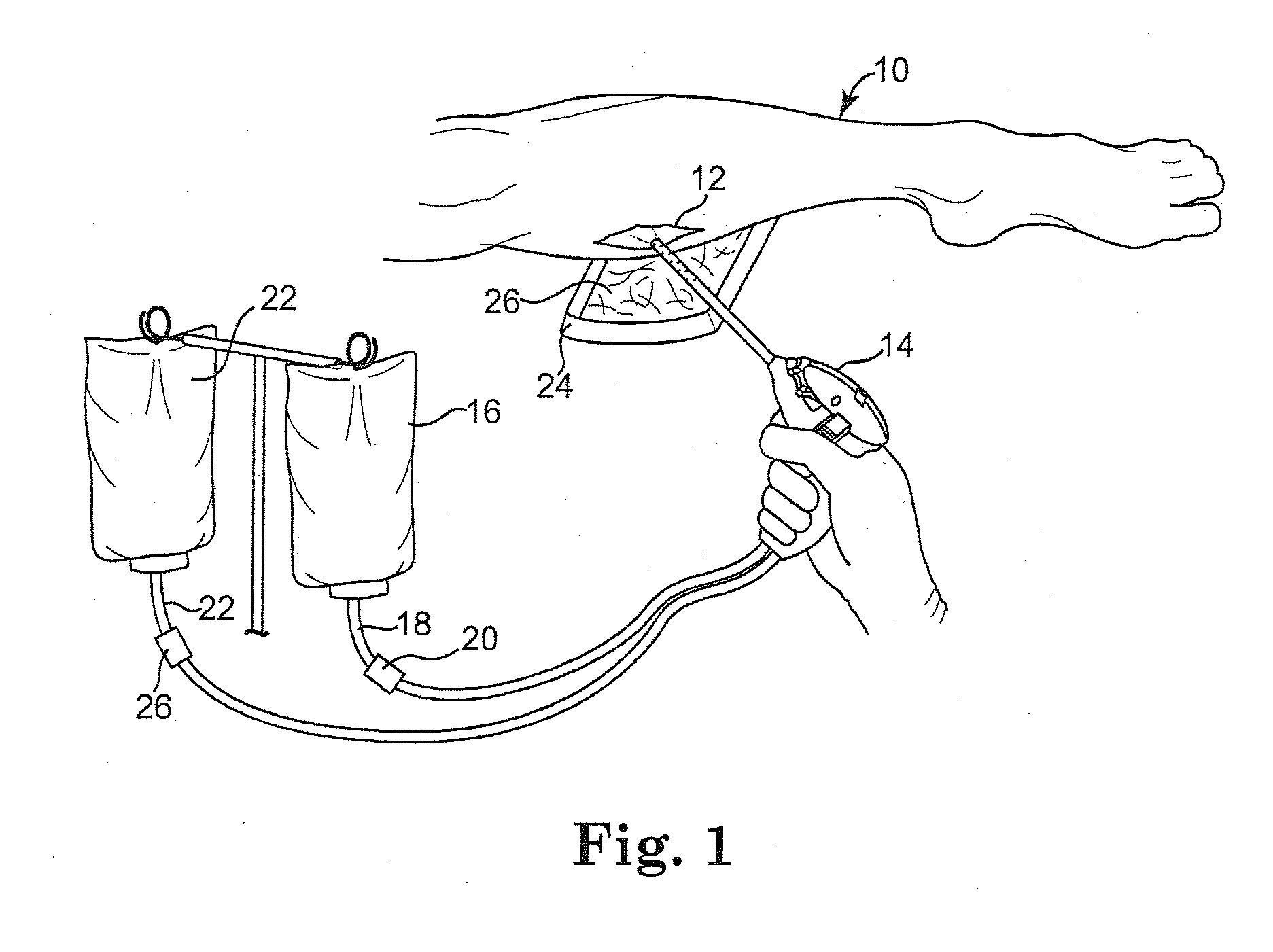 Method for treating chronic wounds with an extracellular polymeric substance solvating system