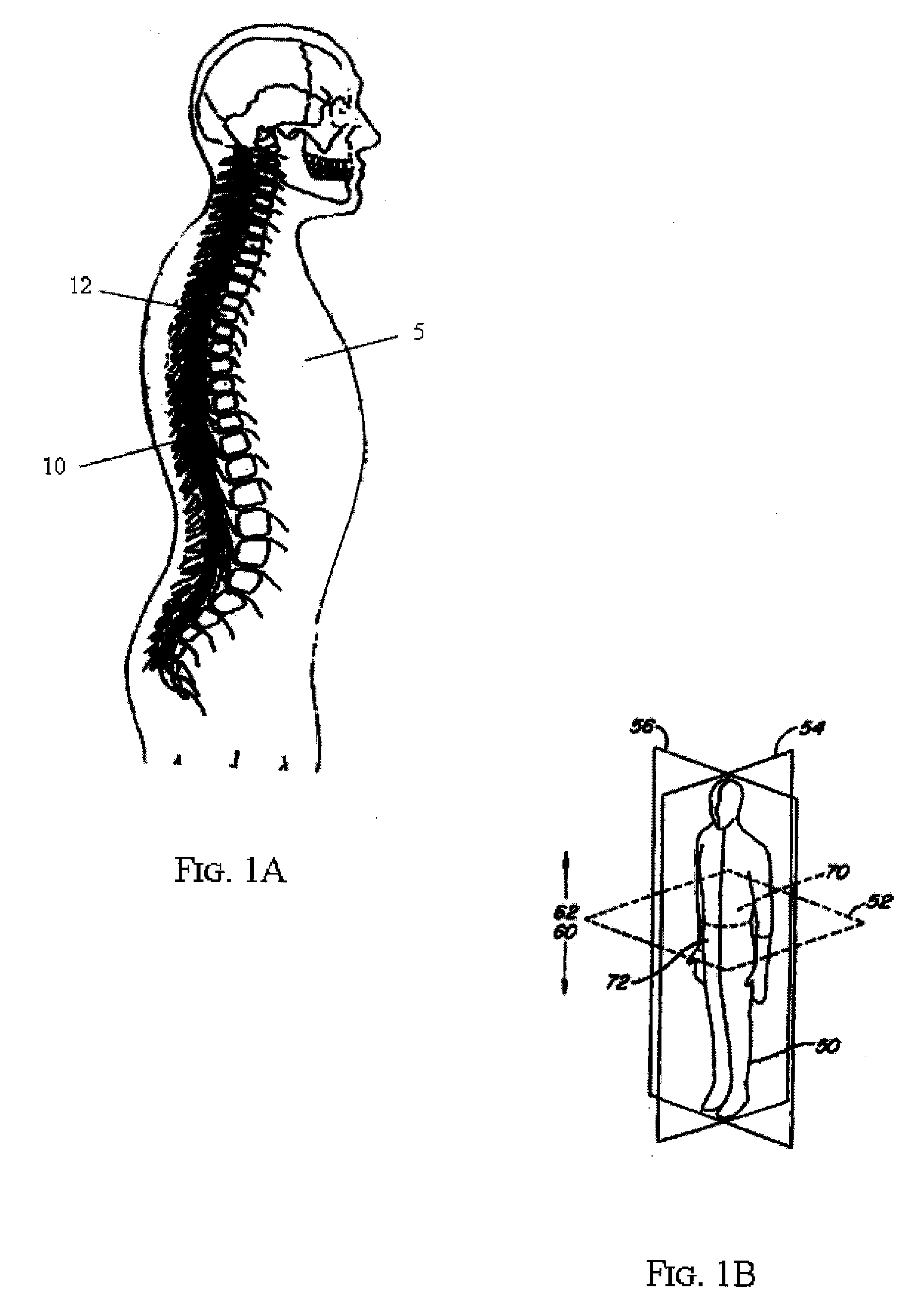 Spinal implant distractor/inserter