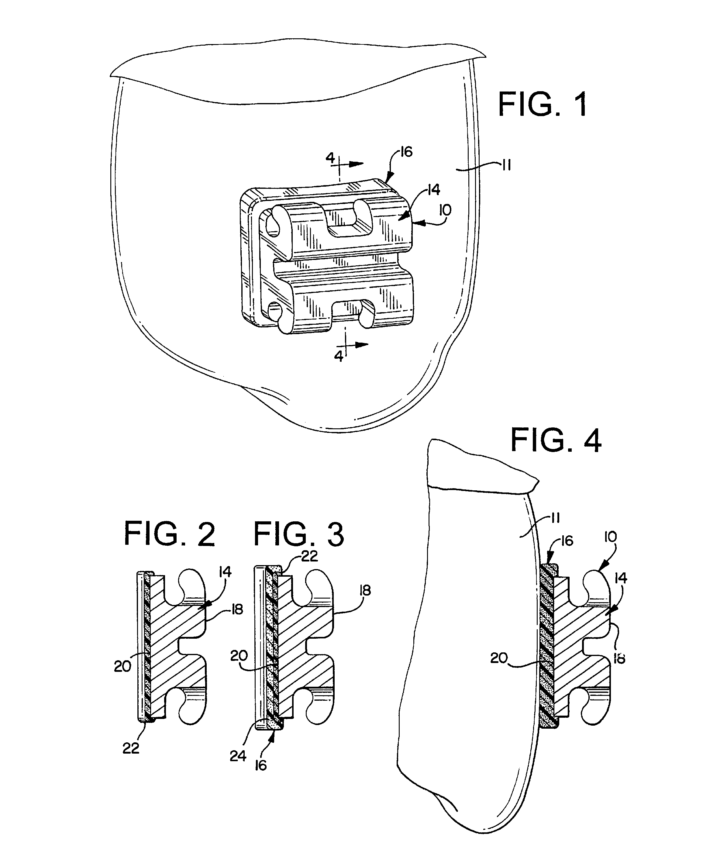 Appliance with bilayer base