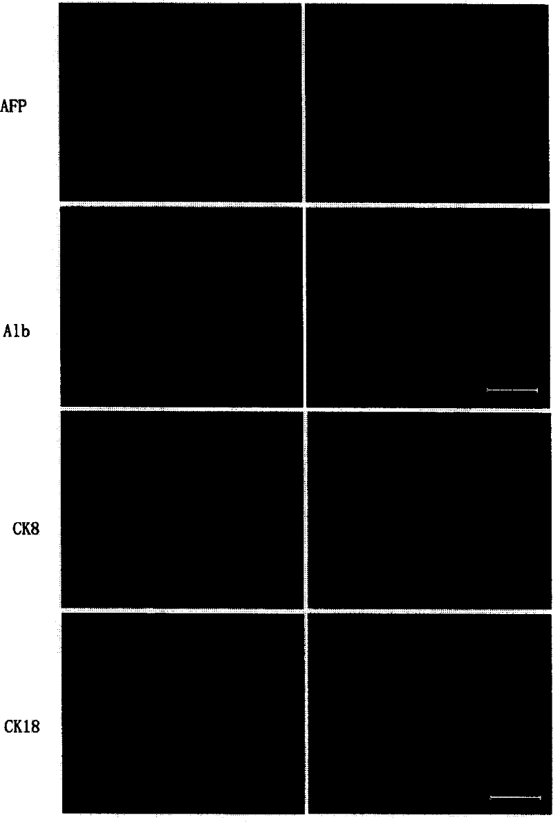 Method for inducing human embryo stem cell differentiation to liver cell and the special-purpose medium