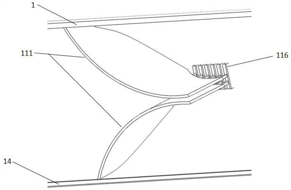 Subcutaneous implantable type improved biliary tract drainage tube