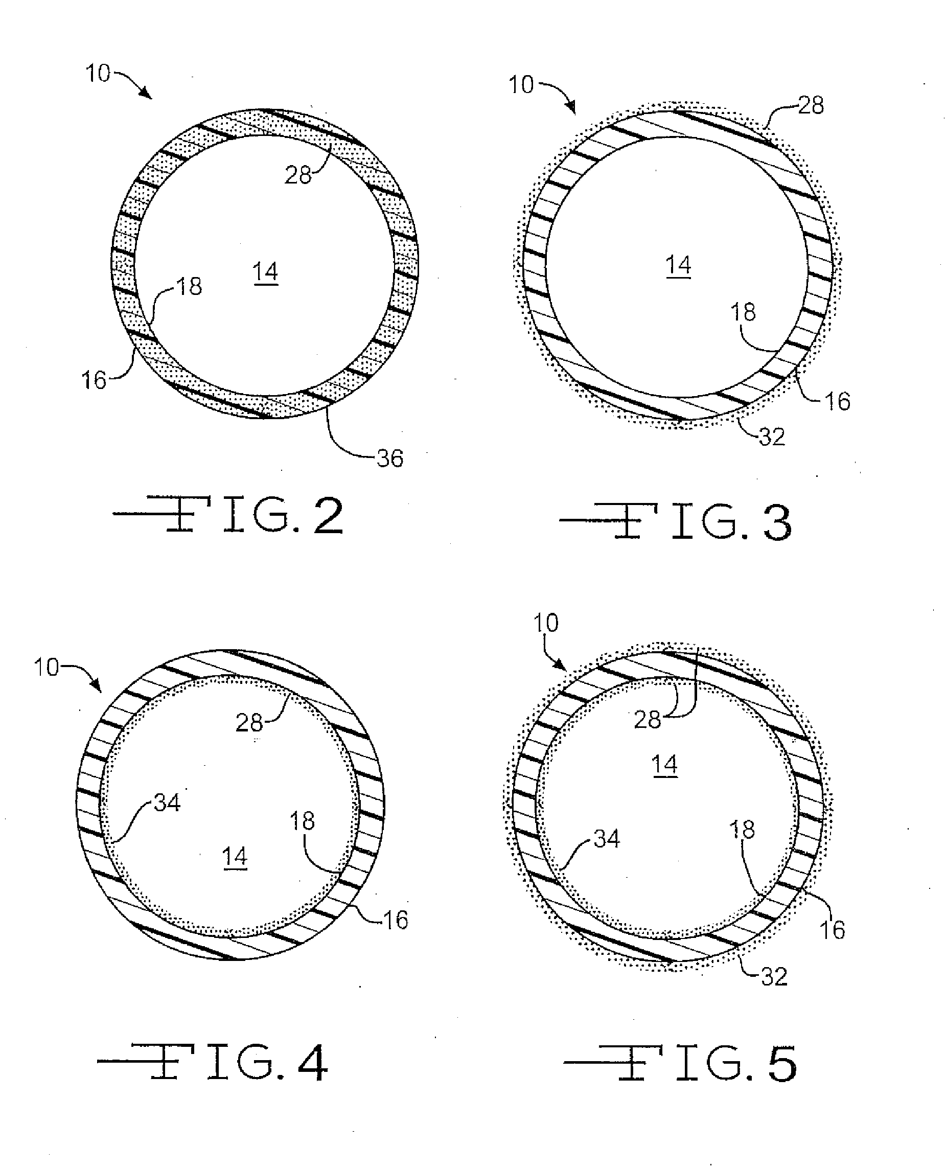 Medical device with therapeutic agents
