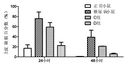 Resveratrol micelle eye drops and preparation method thereof