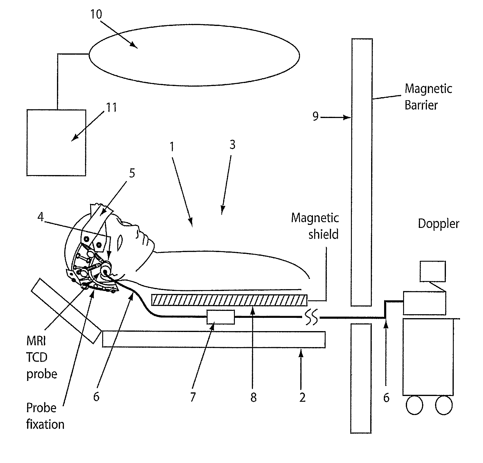 Ultrasound in magnetic spatial imaging apparatus