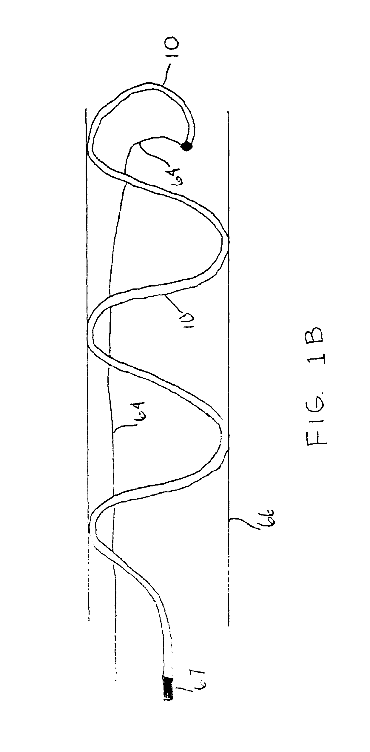 Thrombus removal system and process