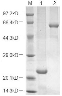 System and method for expressing and purifying recombinant protein with 3'-nucleotidase as tag and application of recombinant protein