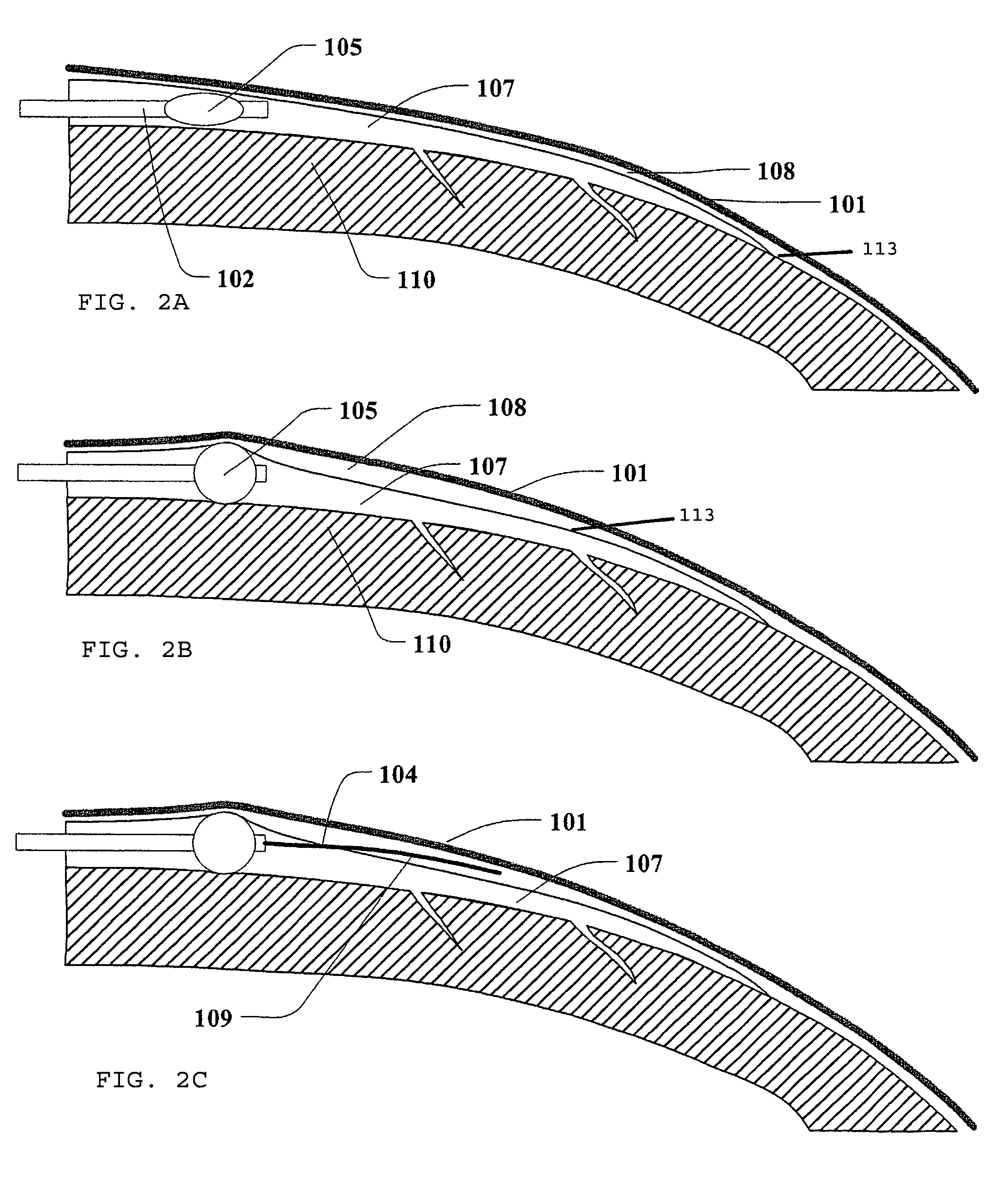 Method and device for accessing a pericardial space