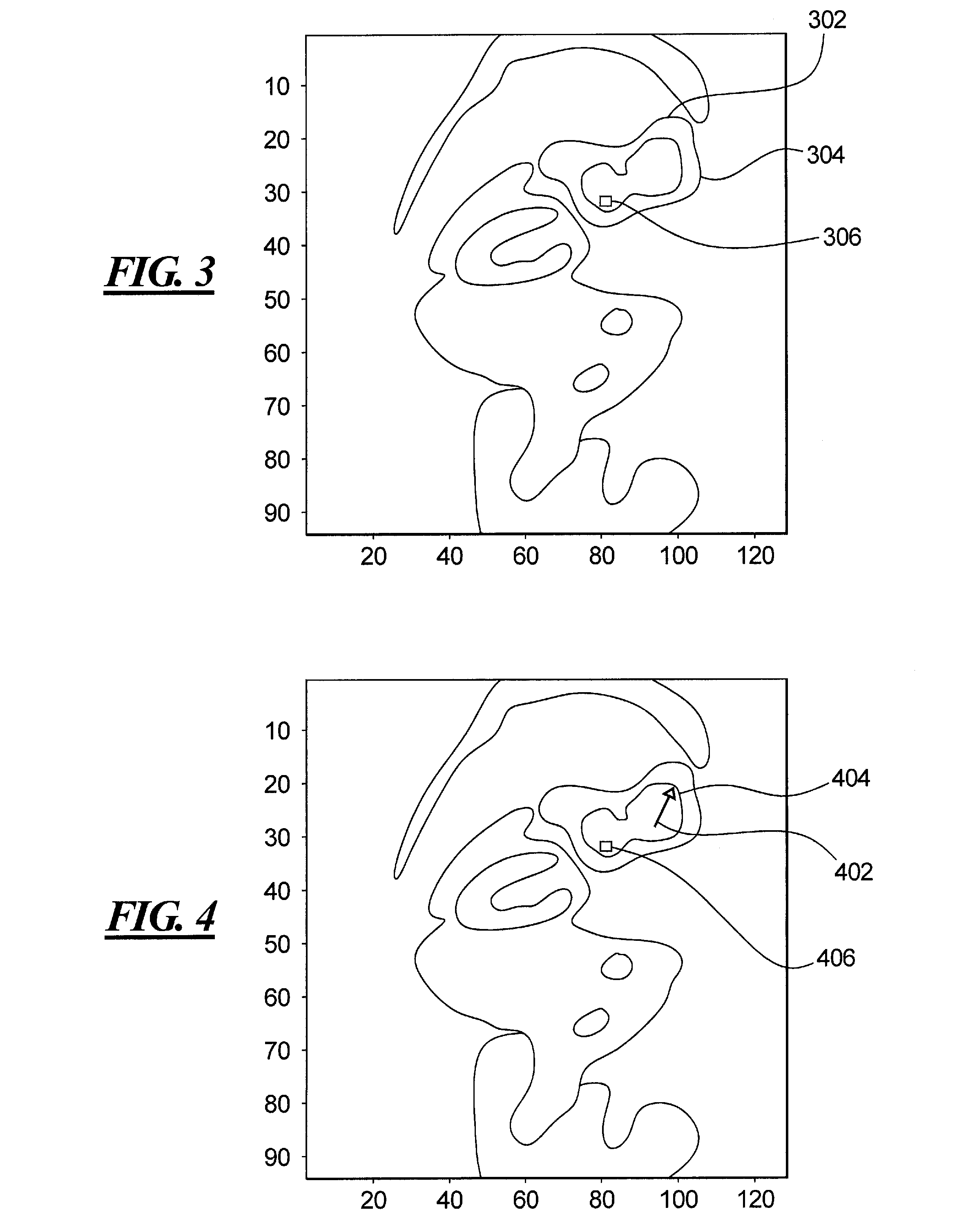 Method and apparatus for identifying regions of interest in a medical image