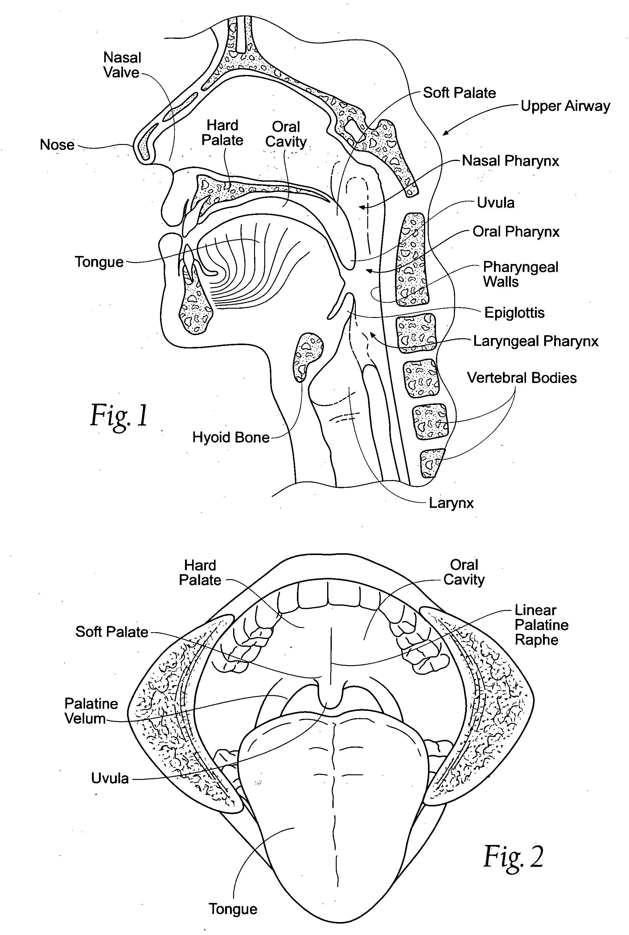 Devices, systems, and methods using magnetic force systems in or on tissue