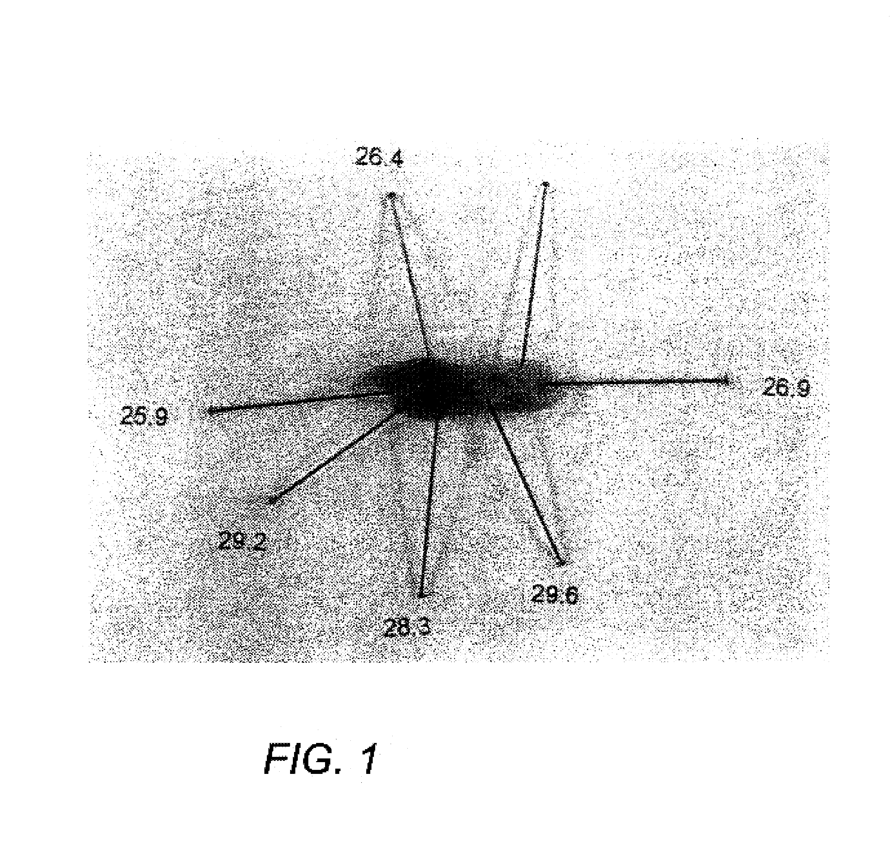 Method and apparatus for detecting vulnerable atherosclerotic plaque
