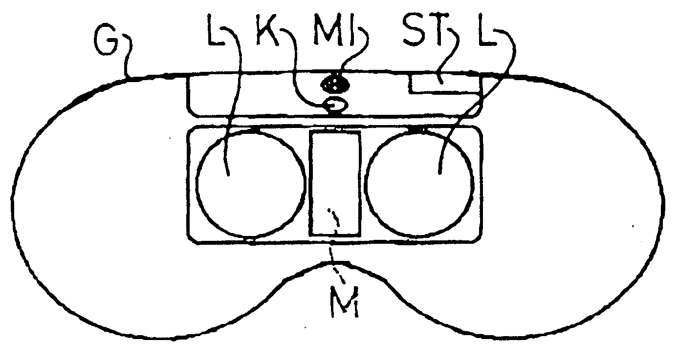 Binocular optical device in particular electronic spectacles, comprising electronic camera for automatically setting focus that includes correction of different vision defects