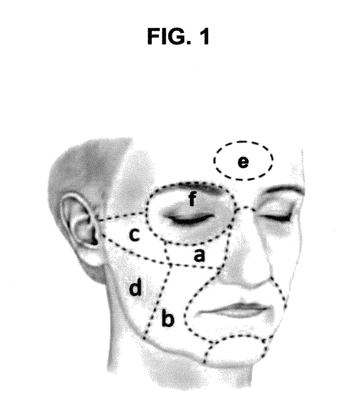 Di-isopropyl-phosphinoyl-alkanes as topical agents for the treatment of sensory discomfort