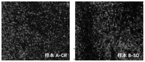 A multiplex immunohistochemical analysis kit for Hodgkin's lymphoma and its using method and application