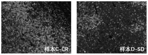 A multiplex immunohistochemical analysis kit for Hodgkin's lymphoma and its using method and application