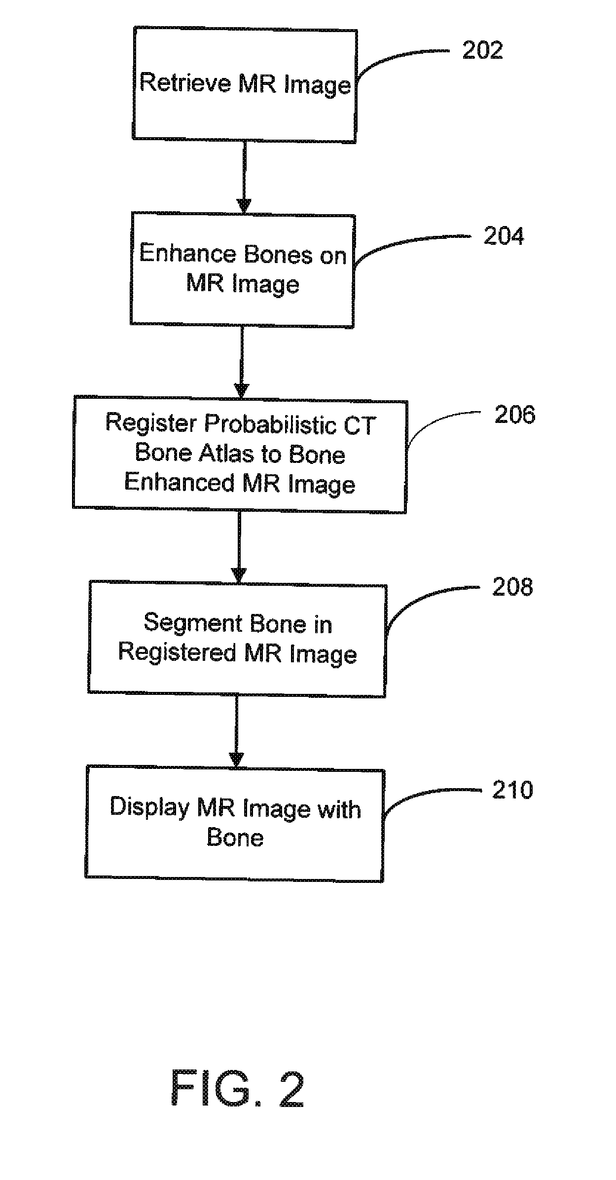 System and method for segmenting bones on mr images