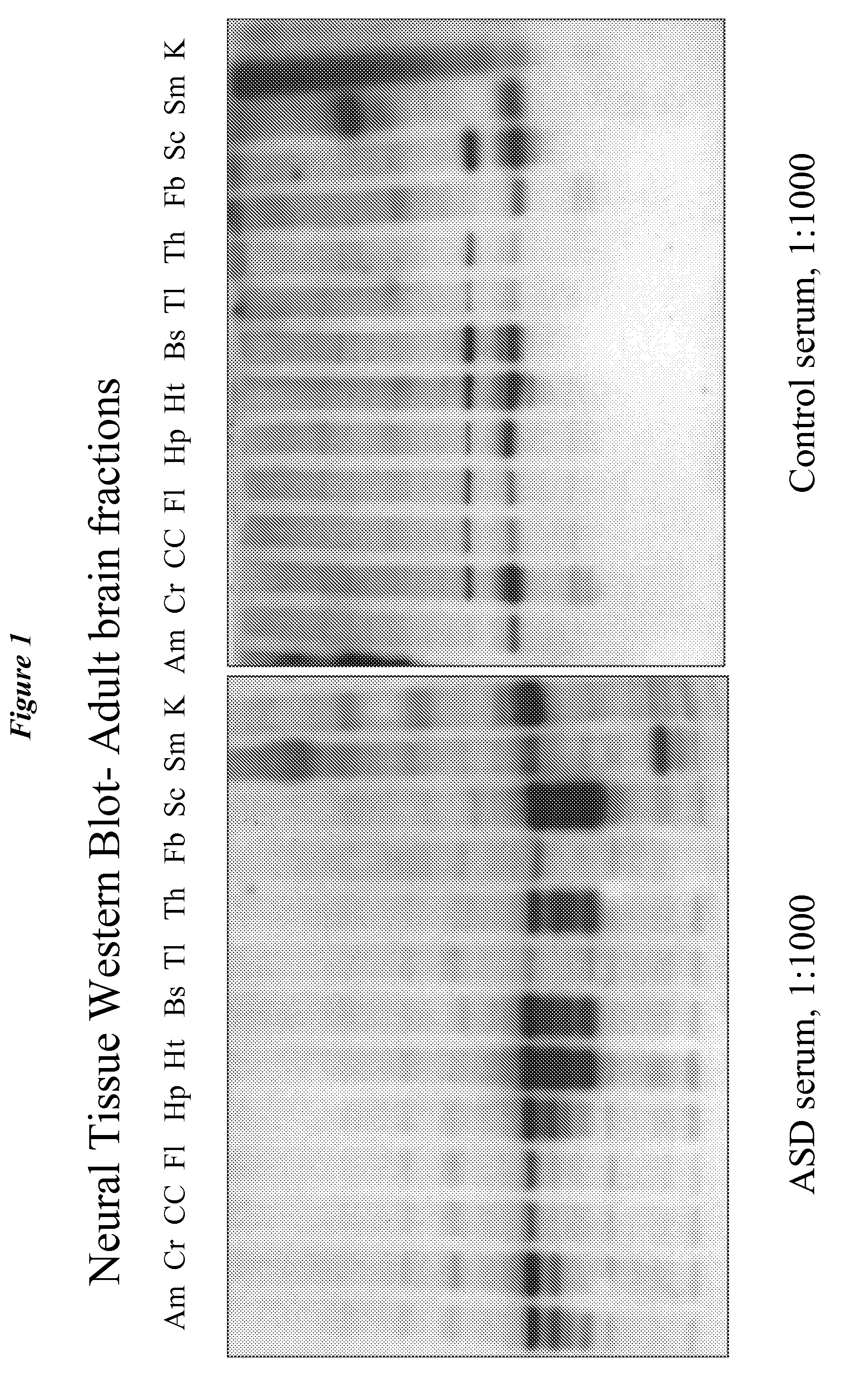 Diagnostic methods for the detection of risk of neurodevelopmental disorders