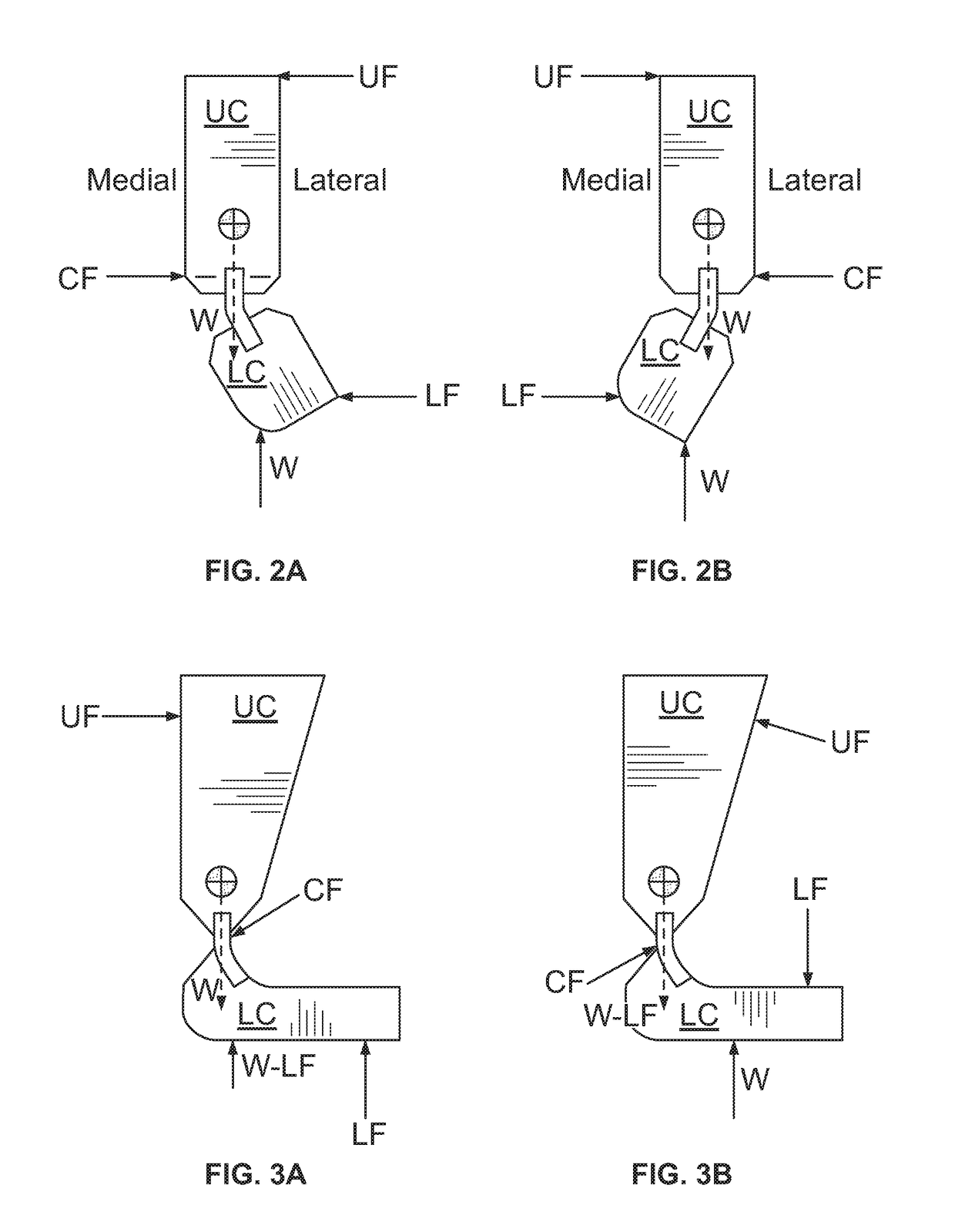 Configurable orthosis and method of definitive orthotic design, fabrication and validation
