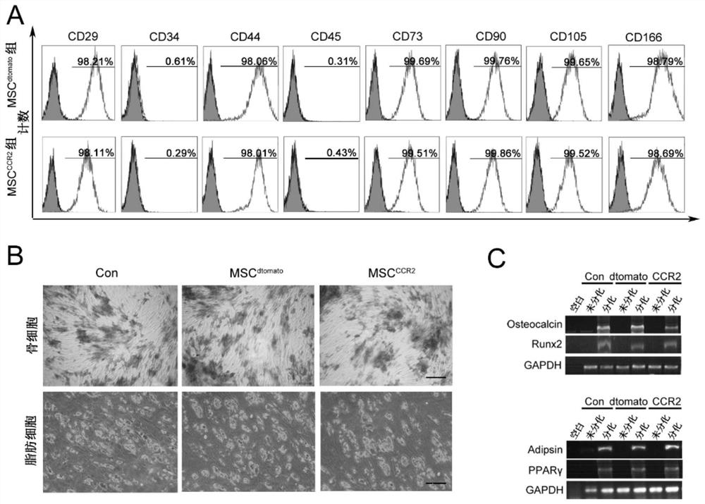 A mesenchymal stem cell overexpressing CCR2 for treating acute ischemic stroke and preparation method thereof