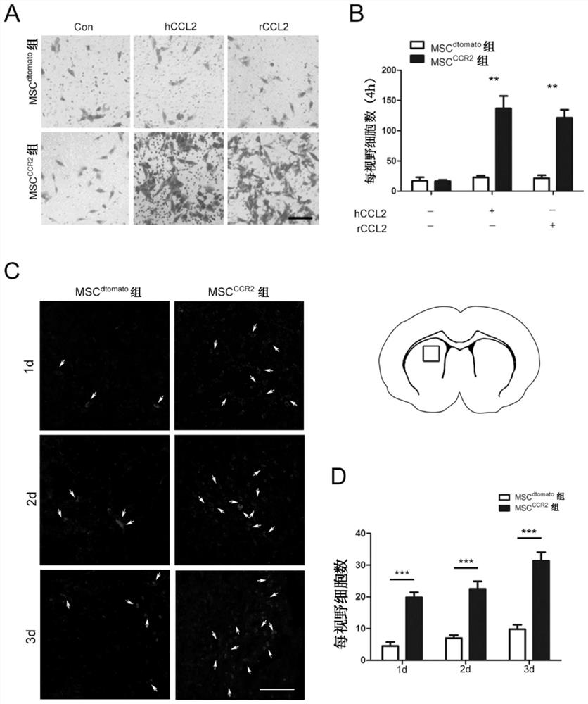 A mesenchymal stem cell overexpressing CCR2 for treating acute ischemic stroke and preparation method thereof