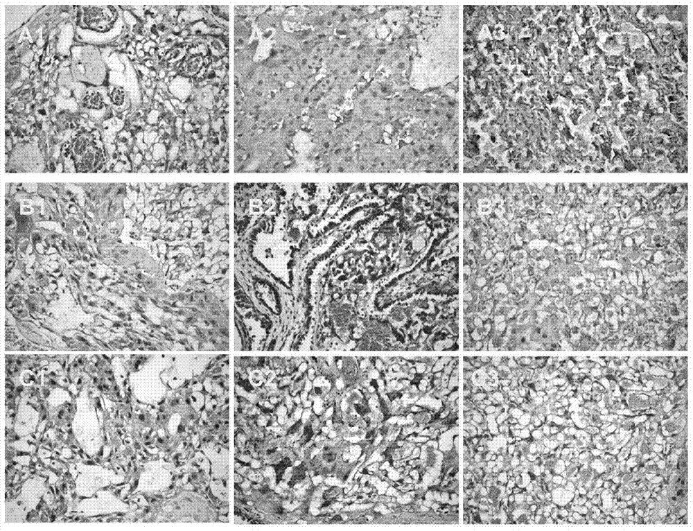 Application of astaxanthin in the preparation of products for the prevention or treatment of preeclampsia