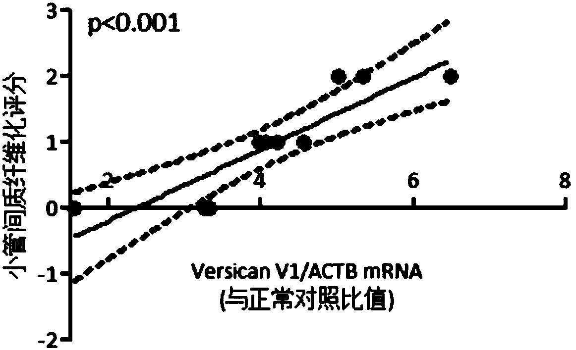 Kit for detecting versican V1mRNA in urine, and application thereof