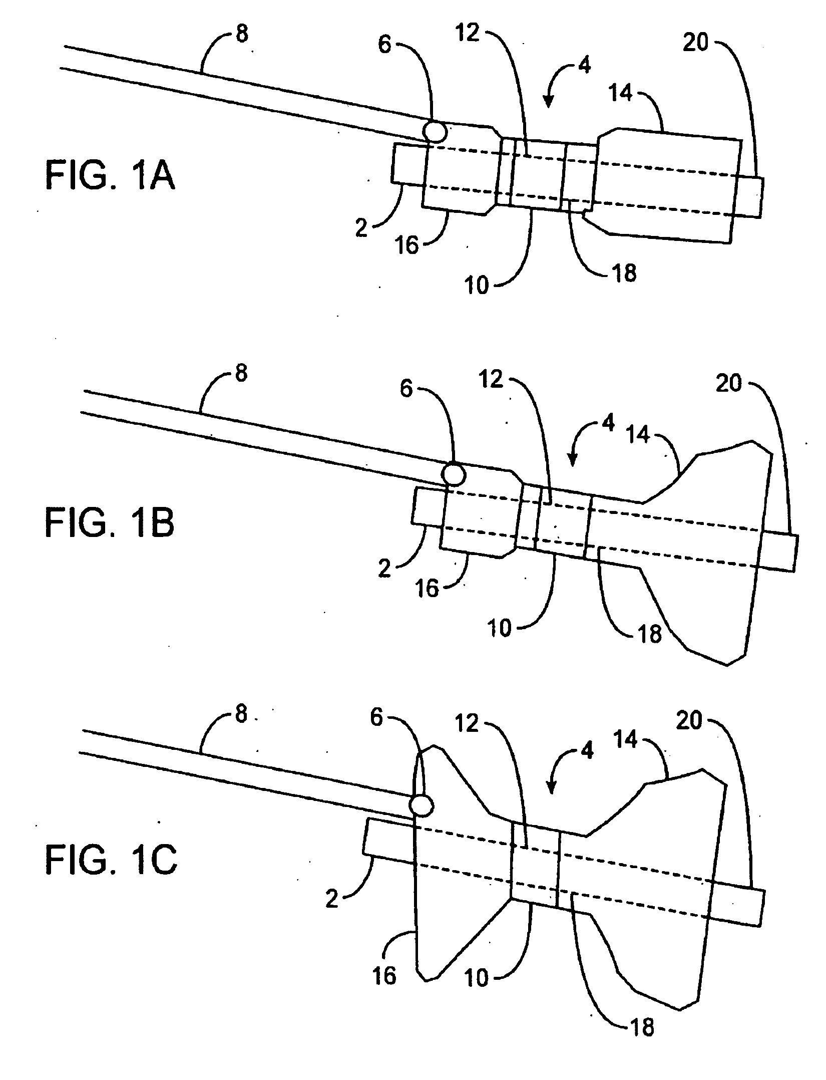 Pyloric valve obstructing devices and methods