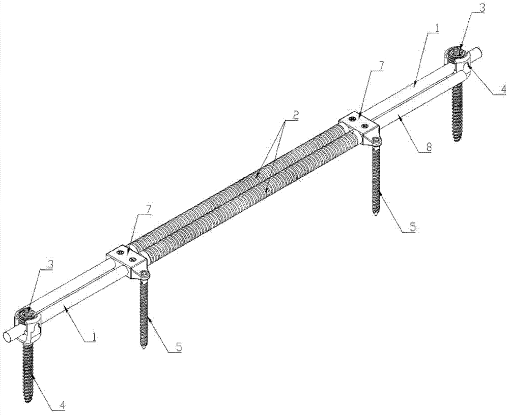 Power-driven automatic stretching correcting system and application thereof