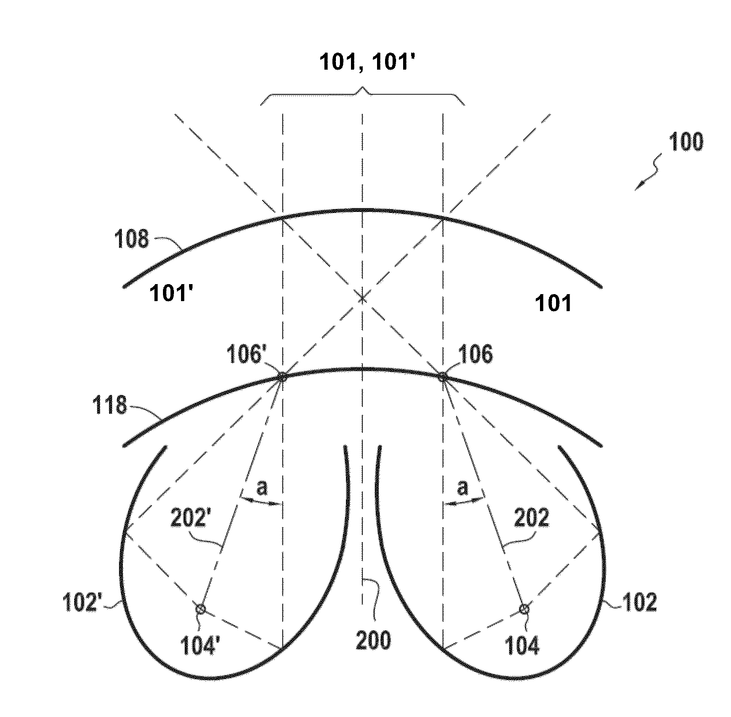 Illuminating module for a motor vehicle