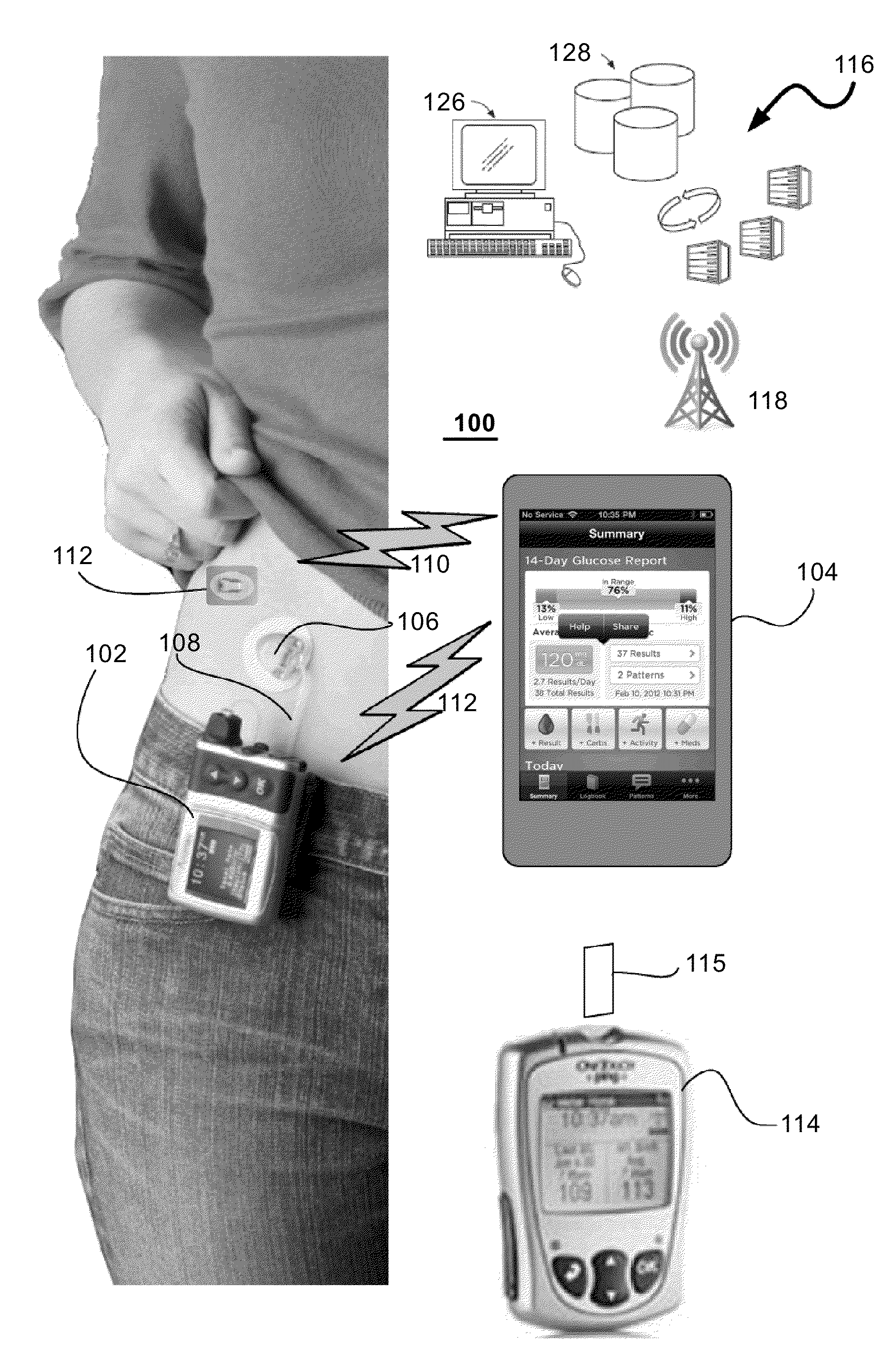 Method and system for closed-loop control of an artificial pancreas