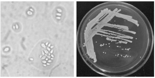 Biocontrol yeast active lyophilized powder and preparation method thereof