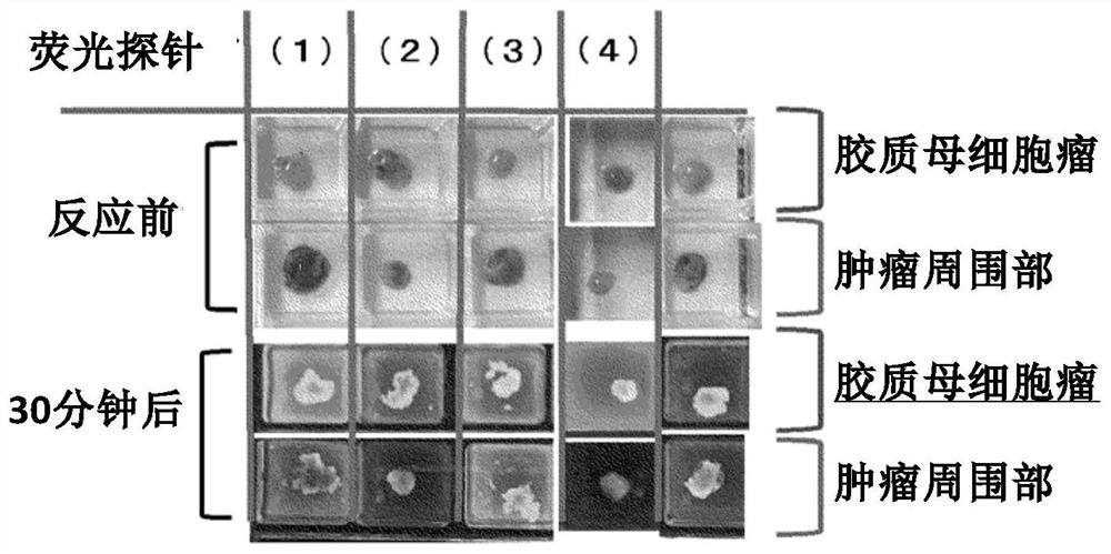 Fluorescent probe for use in detection of brain tumor