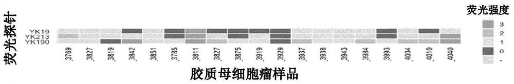 Fluorescent probe for use in detection of brain tumor