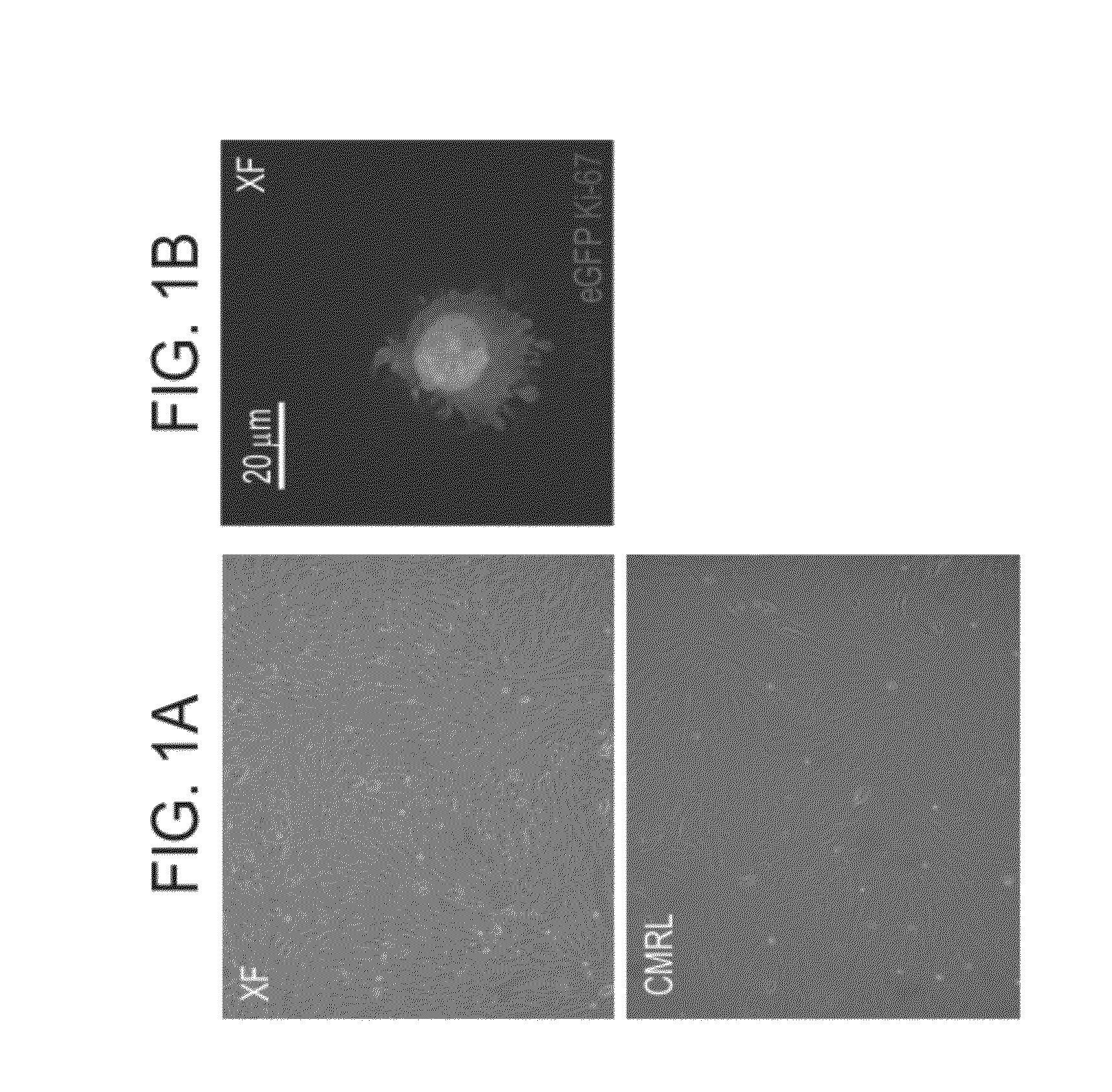 Methods of expanding and redifferentiating islet beta cells