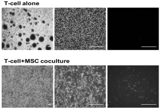 Serum-free medium for mesenchymal stem cells