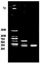 ELISA detection method capable of distinguishing acute and chronic toxoplasma gondii infection and application thereof