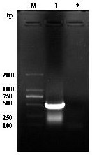 ELISA detection method capable of distinguishing acute and chronic toxoplasma gondii infection and application thereof