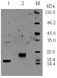 ELISA detection method capable of distinguishing acute and chronic toxoplasma gondii infection and application thereof