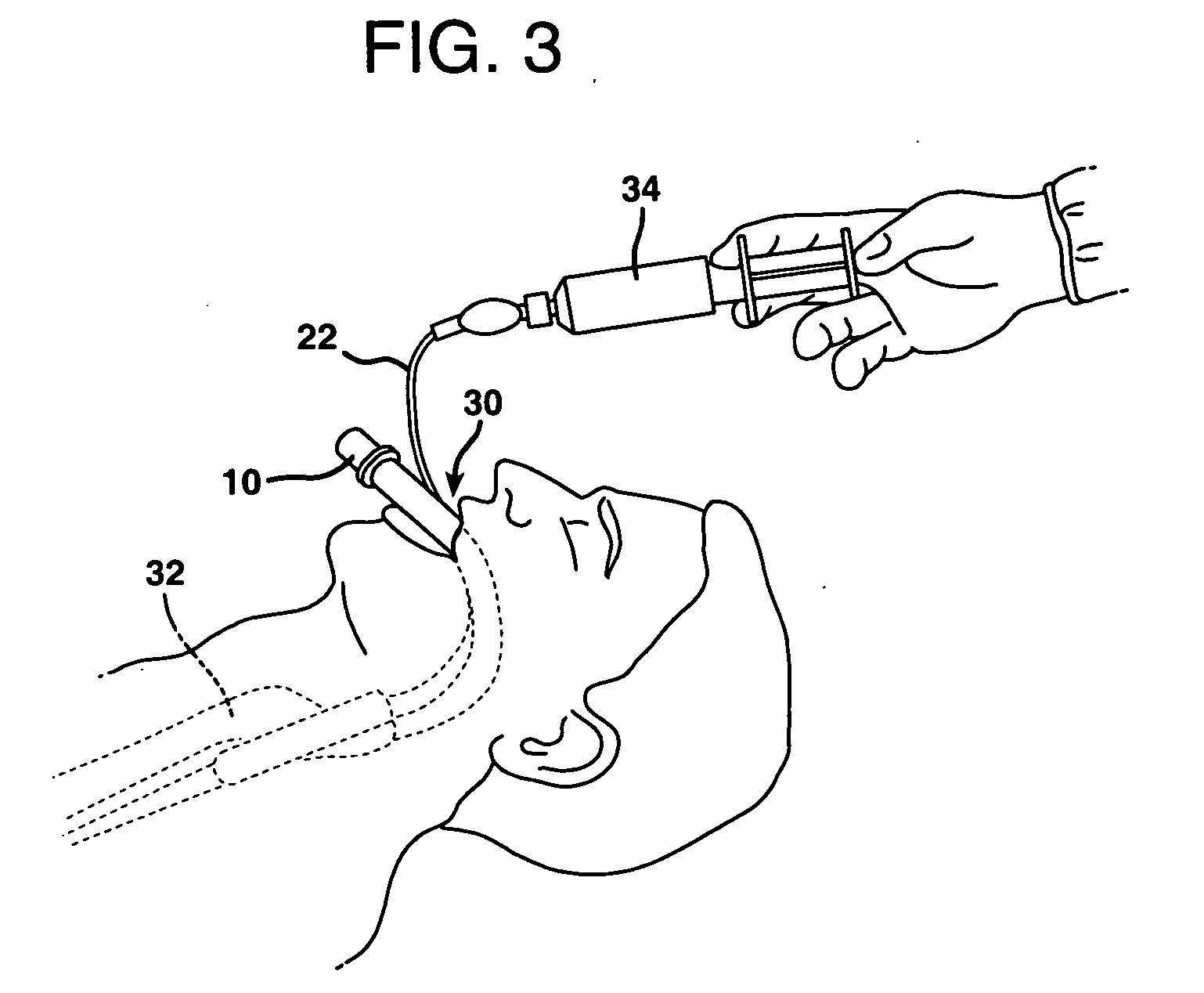 Composition for use with artificial airway devices