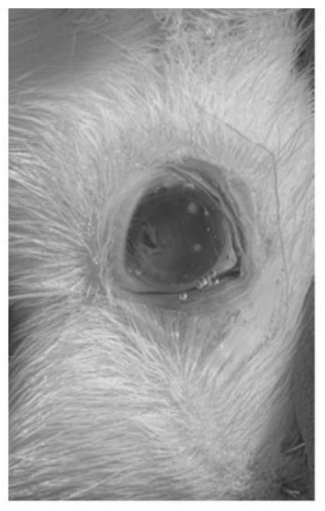 Preparation process of rhegmatogenous retinal detachment preparation