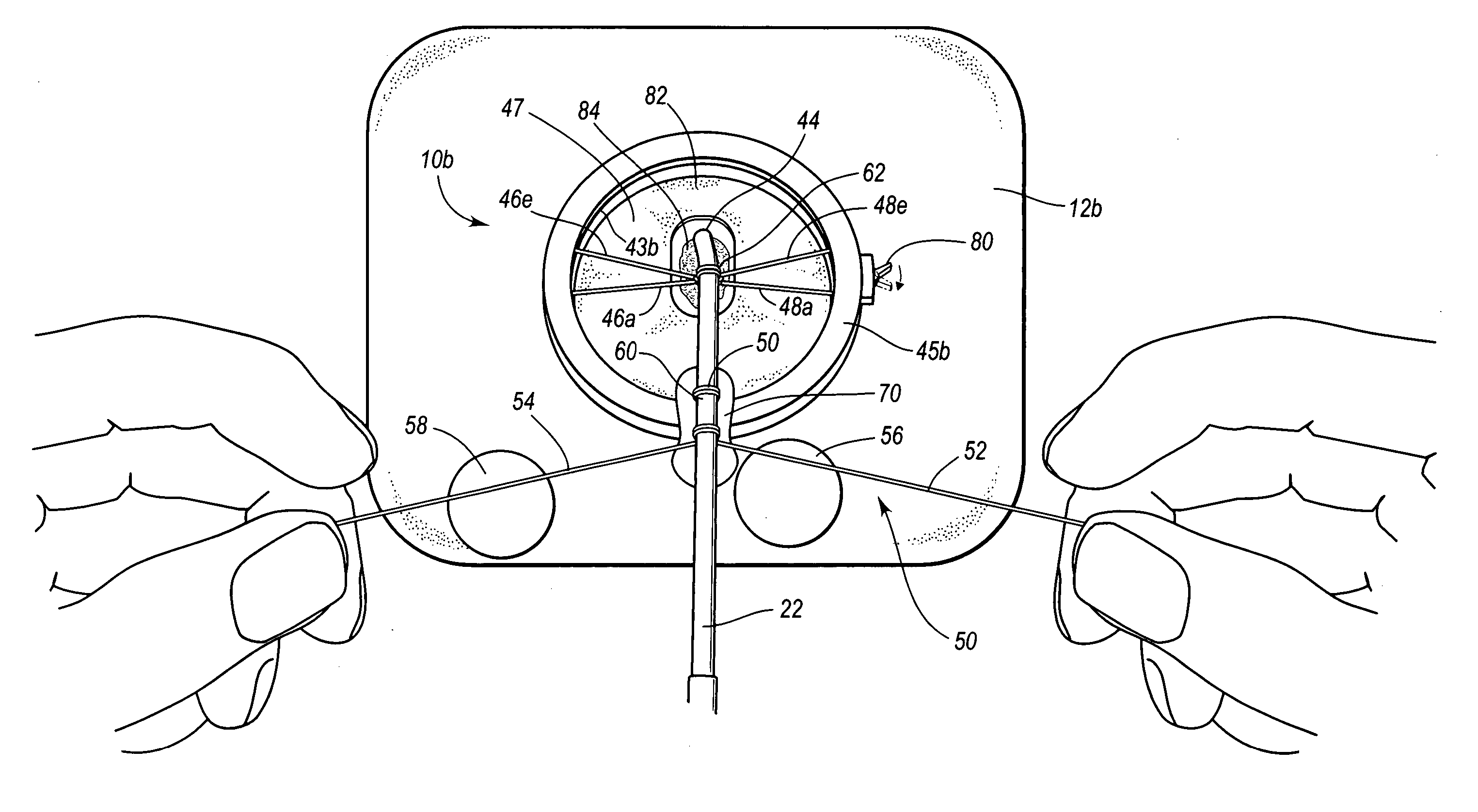 Self-suturing anchor device for a catheter