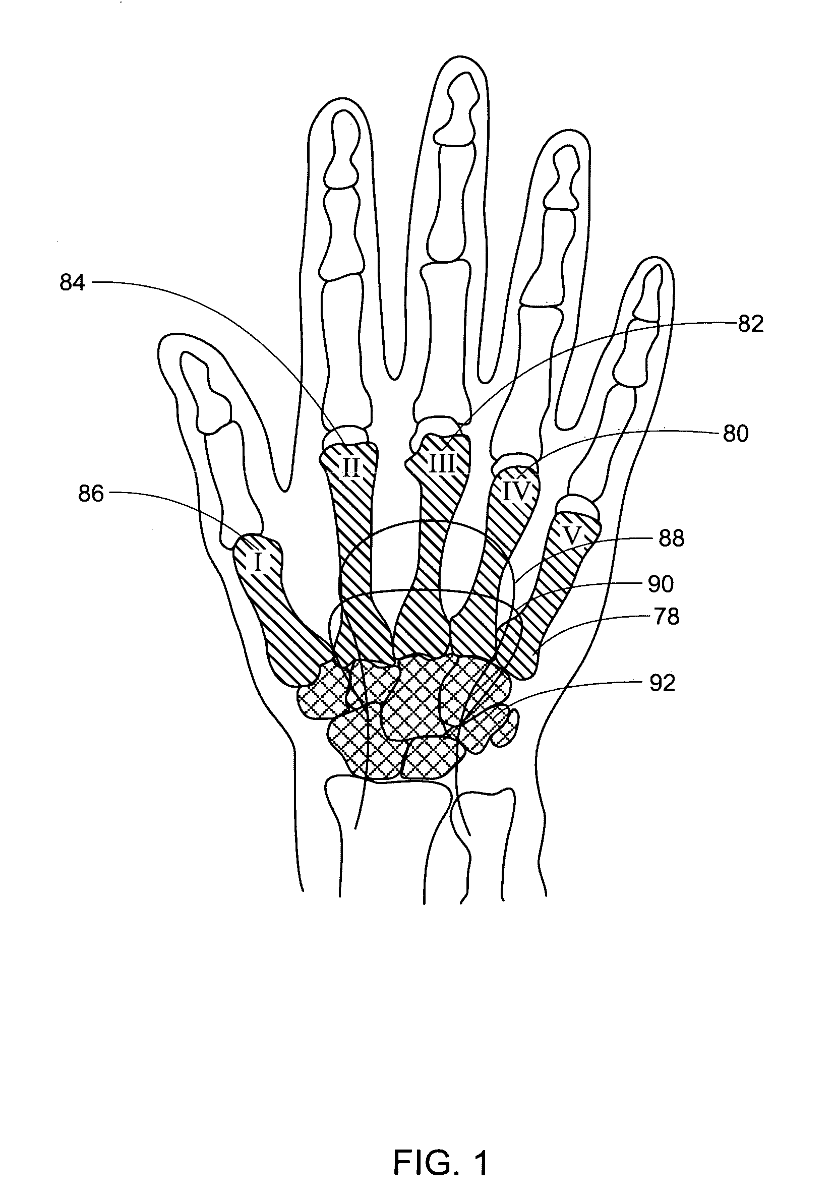 Grip assist apparatus with palm arch support