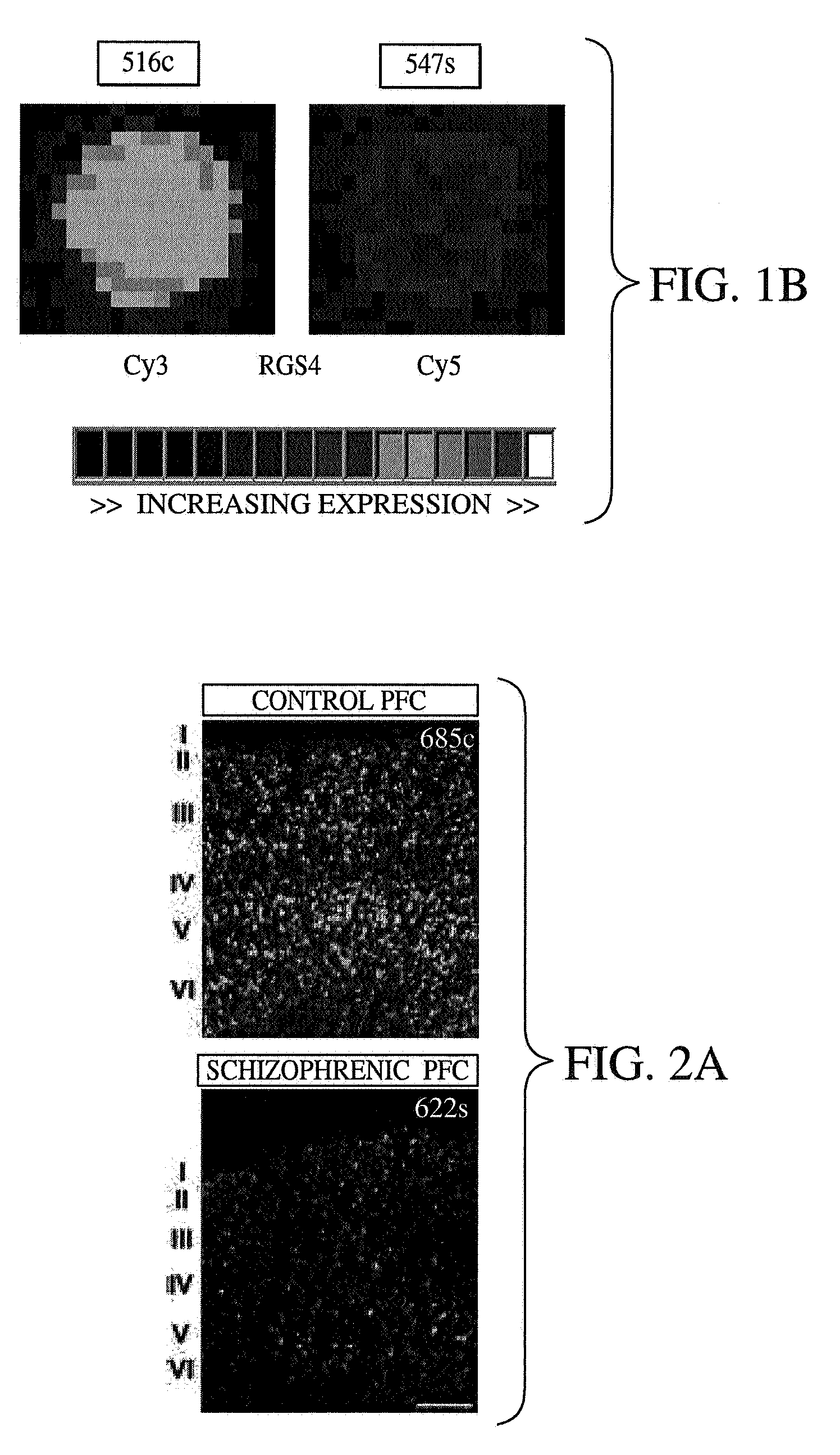 Methods and systems for facilitating the diagnosis and treatment of schizophrenia
