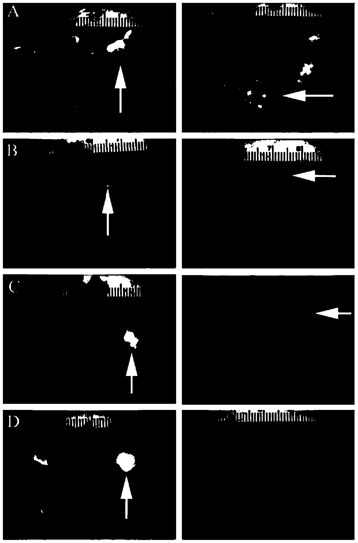 A compound traditional Chinese medicine composition for inhibiting liver metastasis of colorectal cancer, its preparation method and application