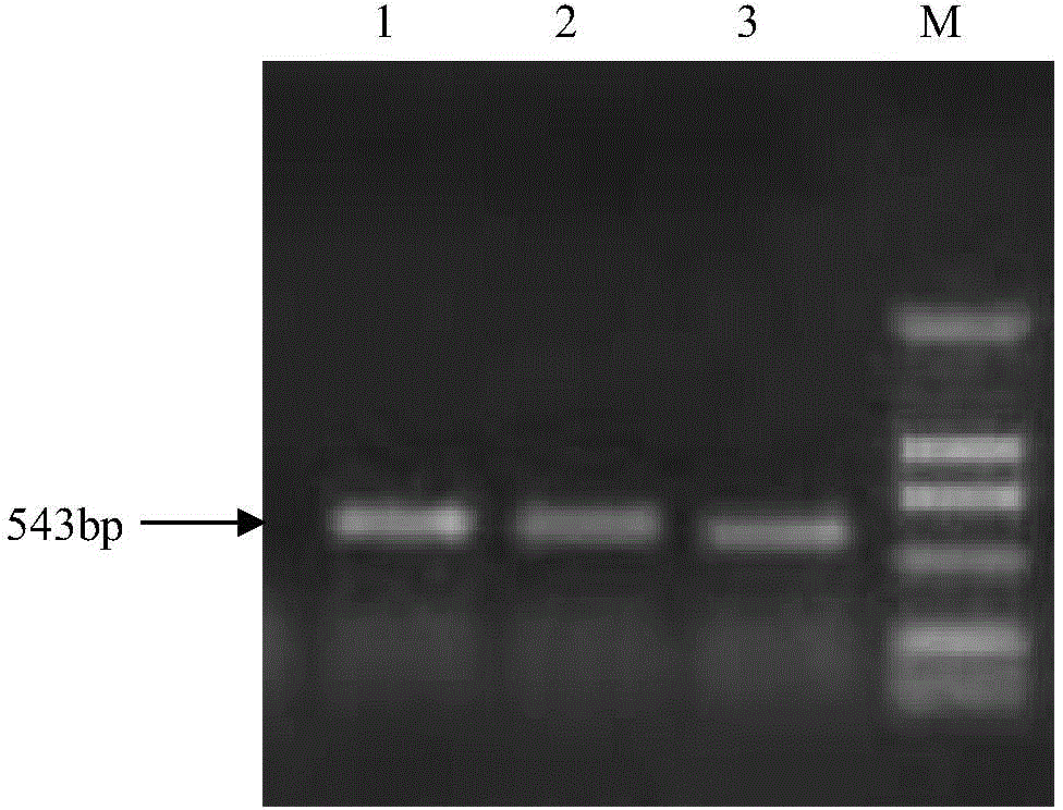 DNA molecule for expressing hairpin RNA for inhibiting macrosiphum avenae lipoprotein lipase and applications thereof