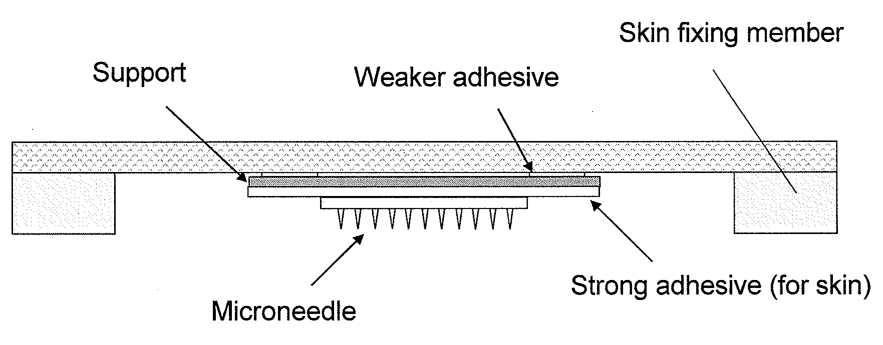 Applicator device of pinholder type microneedle