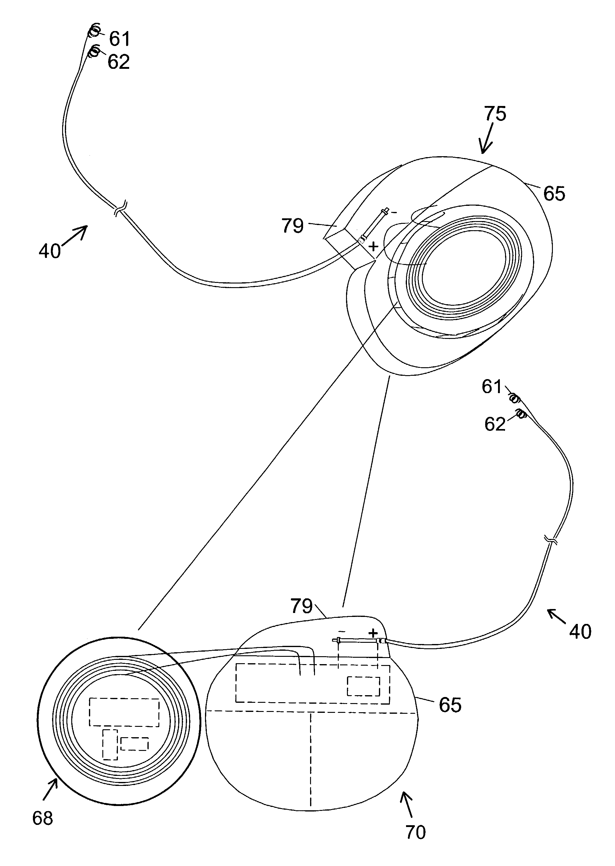 Method and system for providing pulsed electrical stimulation to a craniel nerve of a patient to provide therapy for neurological and neuropsychiatric disorders
