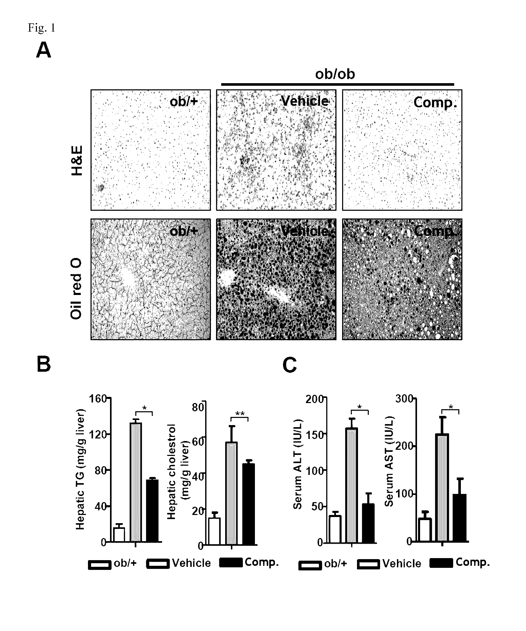 Composition for preventing or treating fatty liver diseases