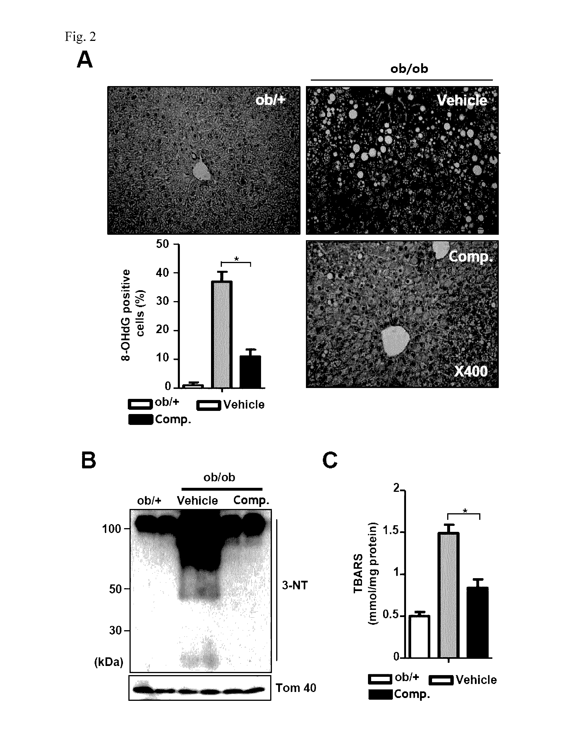 Composition for preventing or treating fatty liver diseases